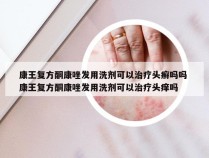 康王复方酮康唑发用洗剂可以治疗头癣吗吗 康王复方酮康唑发用洗剂可以治疗头痒吗