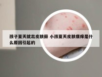 孩子夏天就出皮肤藓 小孩夏天皮肤瘙痒是什么原因引起的