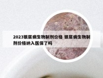 2023银屑病生物制剂价格 银屑病生物制剂价格纳入医保了吗