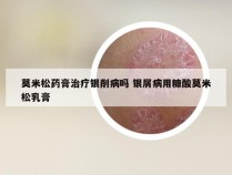 莫米松药膏治疗银削病吗 银屑病用糠酸莫米松乳膏