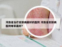 河南省治疗皮肤病最好的医院 河南省皮肤病医院哪家最好?