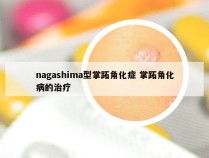 nagashima型掌跖角化症 掌跖角化病的治疗