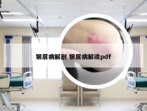 银屑病解剖 银屑病解读pdf