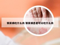 银屑病吃什么肉 银屑病患者可以吃什么肉