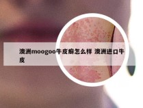 澳洲moogoo牛皮癣怎么样 澳洲进口牛皮