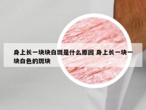 身上长一块块白斑是什么原因 身上长一块一块白色的斑块