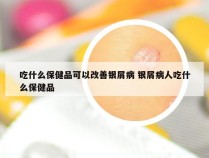 吃什么保健品可以改善银屑病 银屑病人吃什么保健品