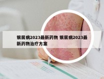 银屑病2023最新药物 银屑病2023最新药物治疗方案