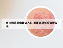 虎皮鹦鹉起癣传染人吗 虎皮鹦鹉长癣会传染吗