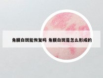 角膜白斑能恢复吗 角膜白斑是怎么形成的