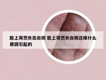 脸上突然长出白斑 脸上突然长白斑还痒什么原因引起的