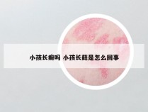 小孩长癣吗 小孩长藓是怎么回事