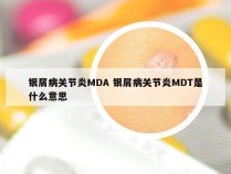 银屑病关节炎MDA 银屑病关节炎MDT是什么意思