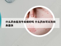 什么药水能洗牛皮癣好吗 什么药水可以洗纹身最快