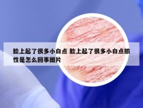 脸上起了很多小白点 脸上起了很多小白点脓性是怎么回事图片