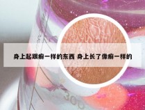 身上起跟癣一样的东西 身上长了像癣一样的