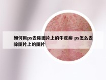 如何用ps去除图片上的牛皮癣 ps怎么去除图片上的图片