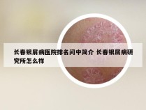 长春银屑病医院排名问中简介 长春银屑病研究所怎么样