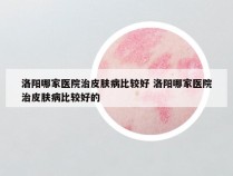 洛阳哪家医院治皮肤病比较好 洛阳哪家医院治皮肤病比较好的