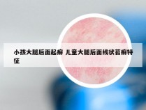 小孩大腿后面起癣 儿童大腿后面线状苔癣特征