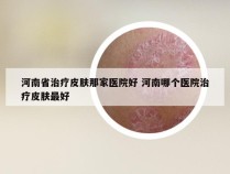 河南省治疗皮肤那家医院好 河南哪个医院治疗皮肤最好