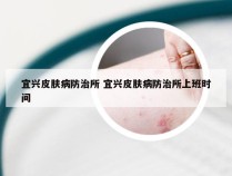 宜兴皮肤病防治所 宜兴皮肤病防治所上班时间