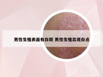 男性生殖表面有白斑 男性生殖出现白点