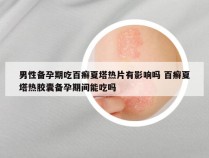 男性备孕期吃百癣夏塔热片有影响吗 百癣夏塔热胶囊备孕期间能吃吗