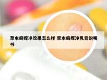 草本癣痒净效果怎么样 草本癣痒净乳膏说明书