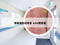 银屑病你问我答 zdm银屑病