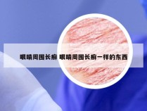 眼睛周围长癣 眼睛周围长癣一样的东西