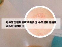 对寻常型银屑病有诊断价值 寻常型银屑病有诊断价值的特征