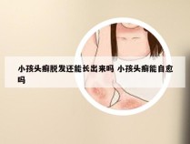 小孩头癣脱发还能长出来吗 小孩头癣能自愈吗