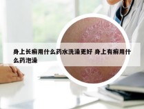 身上长癣用什么药水洗澡更好 身上有癣用什么药泡澡