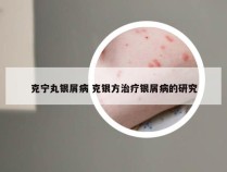 克宁丸银屑病 克银方治疗银屑病的研究