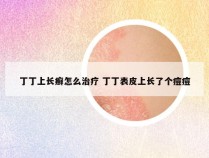 丁丁上长癣怎么治疗 丁丁表皮上长了个痘痘