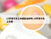 13岁孩子头上长癣能治好吗 14岁孩子头上长癣