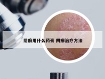 阴癣用什么药膏 阴癣治疗方法