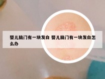 婴儿脑门有一块发白 婴儿脑门有一块发白怎么办