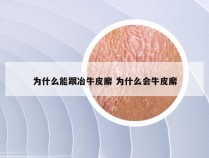 为什么能跟冶牛皮廨 为什么会牛皮廨