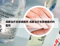 成都治疗皮肤病医院 成都治疗皮肤病最好的医院