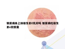 银屑病身上抹维生素E乳好吗 银屑病吃维生素e软胶囊