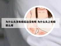 为什么头顶有癣后边没有呢 为什么头上有癣那么痒