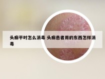 头癣平时怎么消毒 头癣患者用的东西怎样消毒