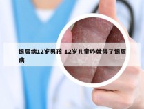 银屑病12岁男孩 12岁儿童咋就得了银屑病