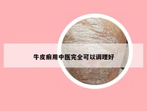 牛皮癣用中医完全可以调理好