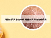 用什么药药浴治疗癣 用什么药药浴治疗癣病