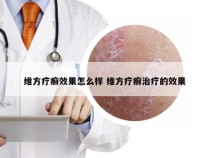 维方疗癣效果怎么样 维方疗癣治疗的效果