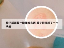 脖子后面长一块像癣东西 脖子后面起了一小块癣