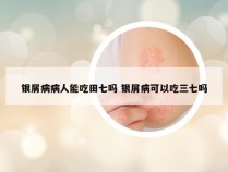 银屑病病人能吃田七吗 银屑病可以吃三七吗